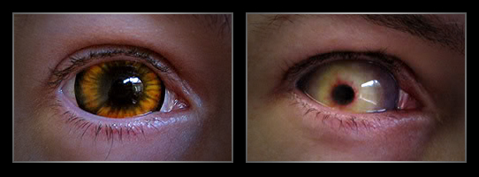 coloured contact lenses1 Fresh Look With Coloured Contact Lenses