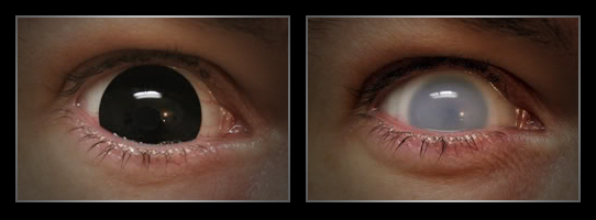 coloured contact lenses19 Fresh Look With Coloured Contact Lenses