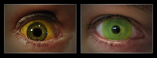 coloured contact lenses3 Fresh Look With Coloured Contact Lenses
