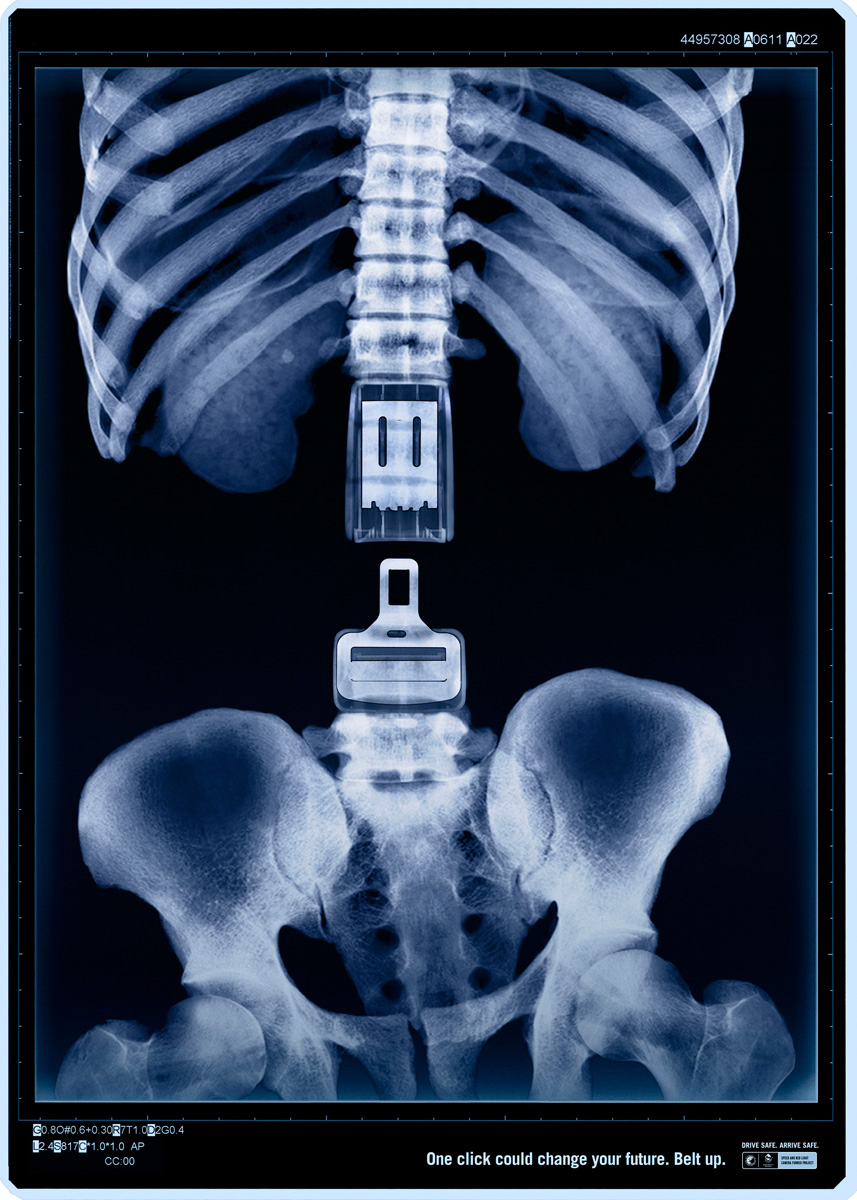 x ray One click Could Safe Your Life