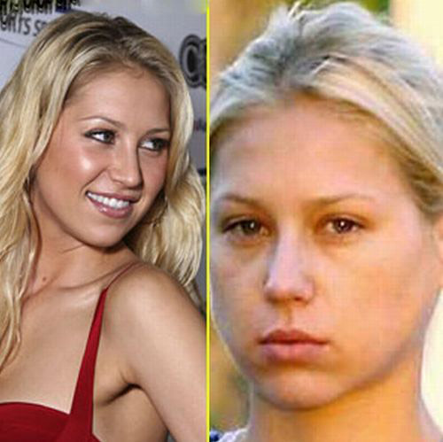 celebrities without makeup1 Celebrities With and Without MakeUp