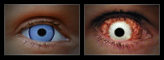 coloured contact lenses9 Fresh Look With Coloured Contact Lenses