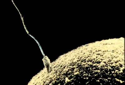 sperm motility9 Get Pregnant of Partners Lazy Sperm