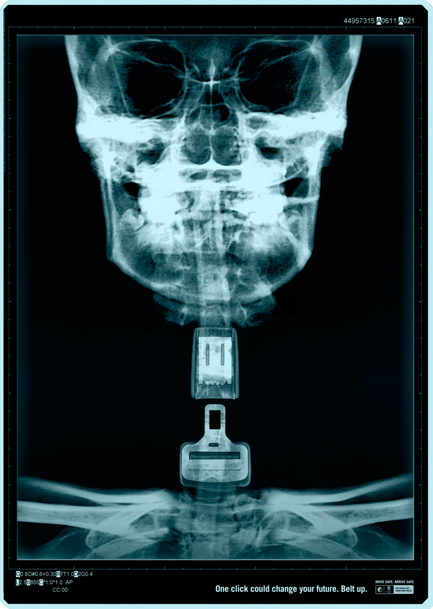 x ray1 One click Could Safe Your Life